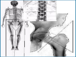 densitometriaossea